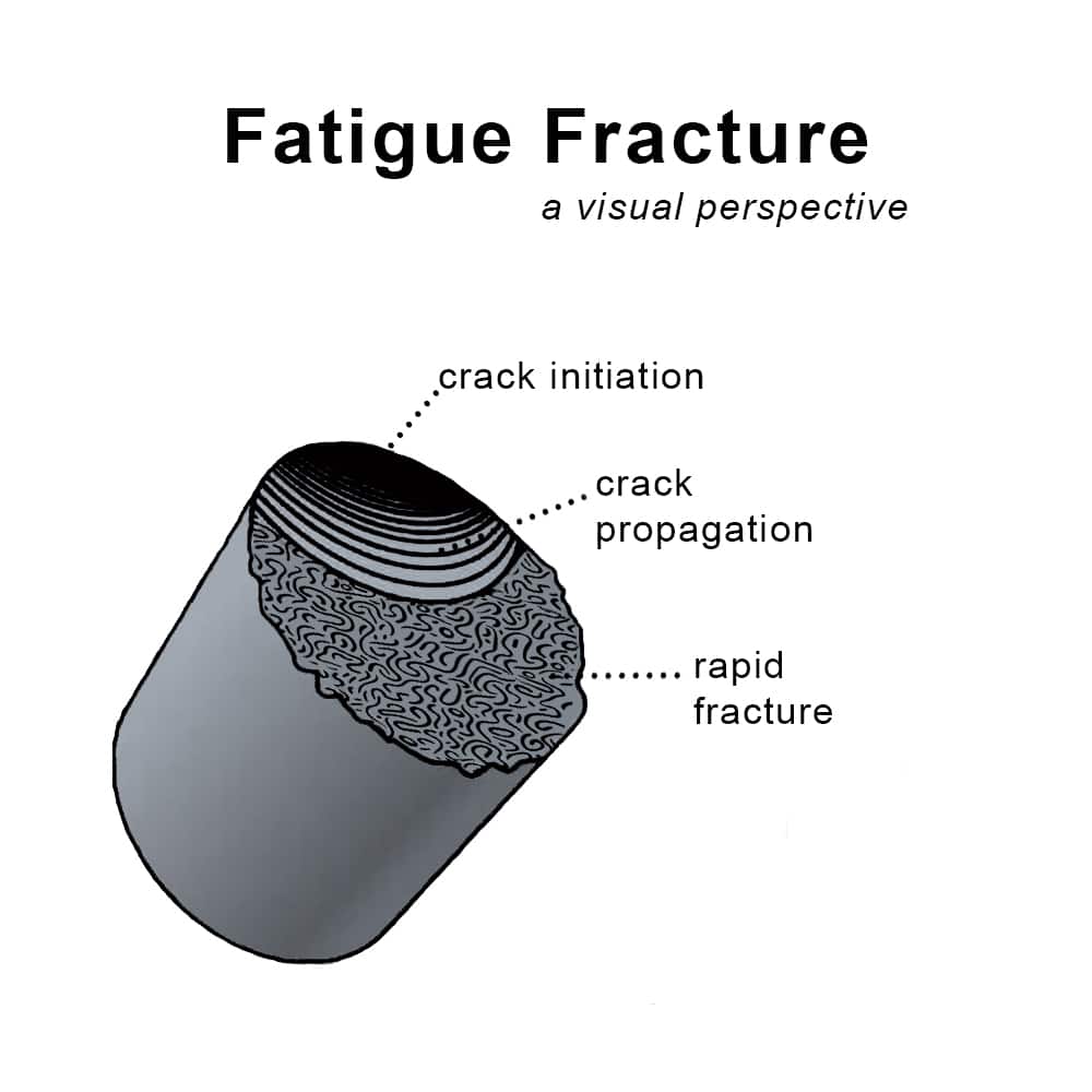 fatigue fracture illustration