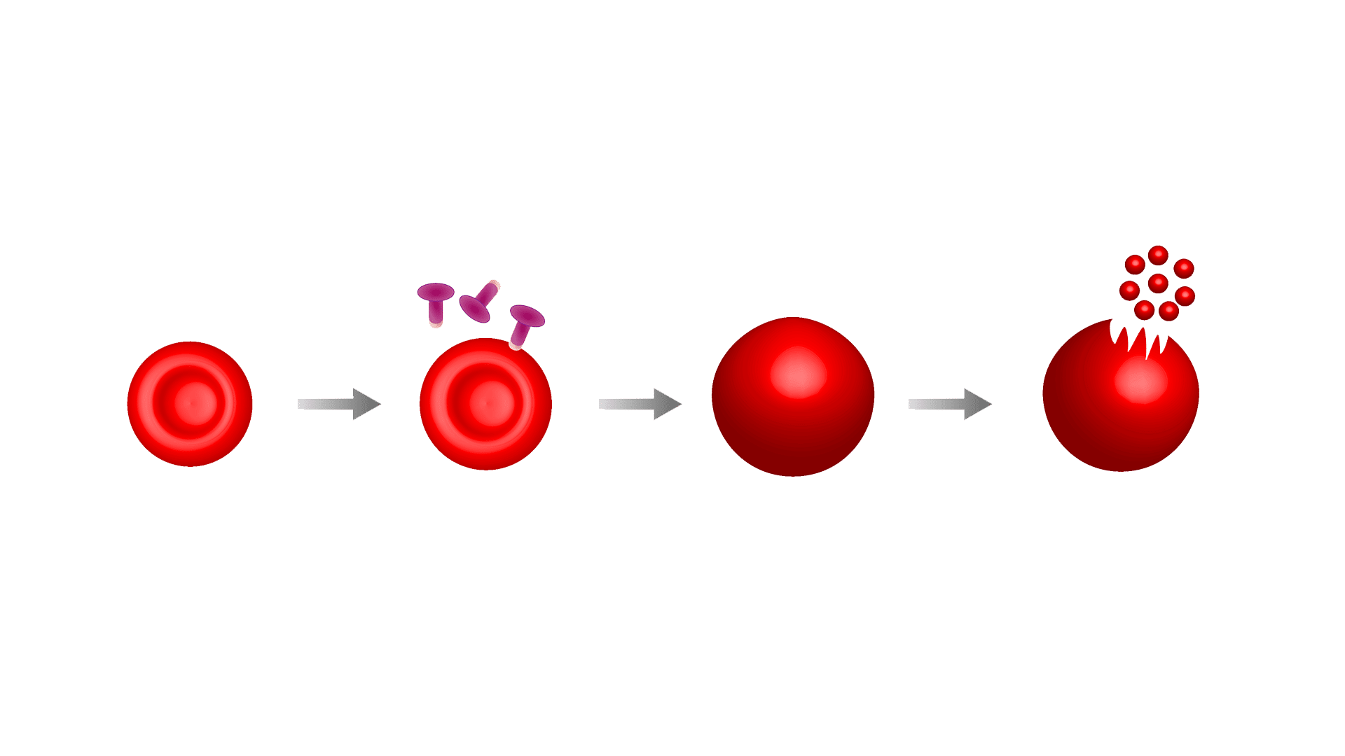 hemolysis stages illustration