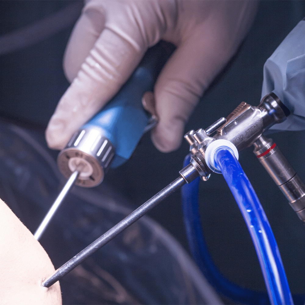 Stainless steel endoscopic cutters compliant with ISO 10993-1 biocompatibility testing for safe medical applications